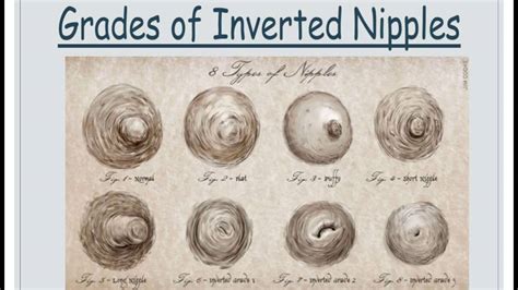 premature infant and inverted nipples bcit youtube