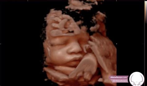 bellies ultrasound pregnancy spa atlanta