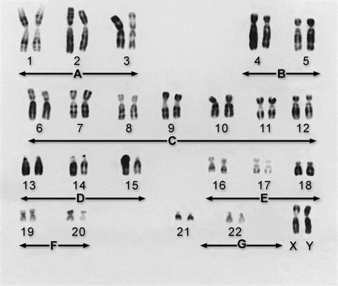 Genes Y Cromosomas