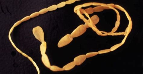 Fighting Feline Worms Tapeworms Of Uk Cats Vet Times