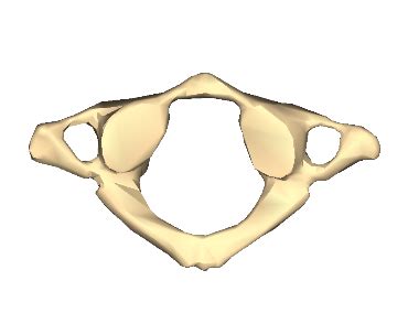 solved identify  atypical vertebra pictured  cheggcom