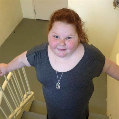 Happier Girl Obesity Surgery Already A Boon Mom Says Nbc News