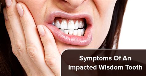 symptoms   impacted wisdom tooth oakville place dental