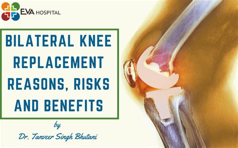 Bilateral Knee Replacement Reasons Risks And Benefits Eva Hospital