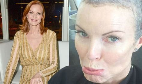 Marcia Cross Desperate Housewives Star Gives Health Update After Anal
