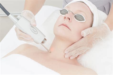 laser hair removal permanent hair removal technology at d thomas