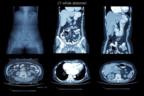 ct scan fairview imaging center