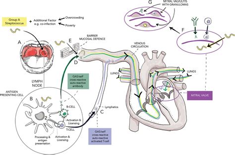 pathophysiology immune response diagram