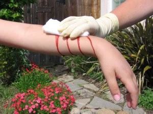 hoe stop je een ernstige bloeding eerste hulp ehbo menselijk lichaam menselijk lichaam