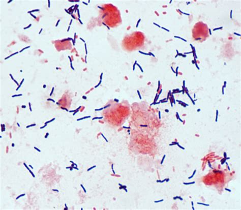 Photo Gallery Of Pathogenic Bacterial