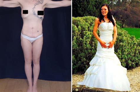Boob Job Bride Was Left With Saggy Skin And Flat Breasts