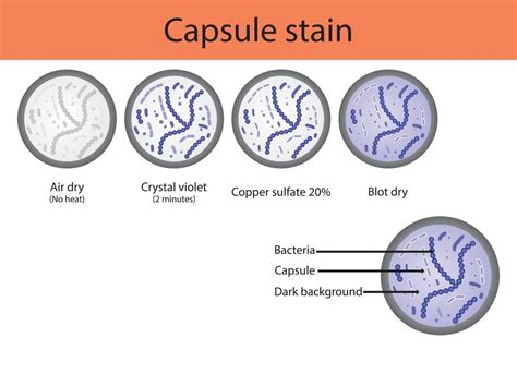 capsule stain  principle reagents procedure  results