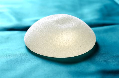 allergan biocell textured breast implant lawsuits seeger weiss llp
