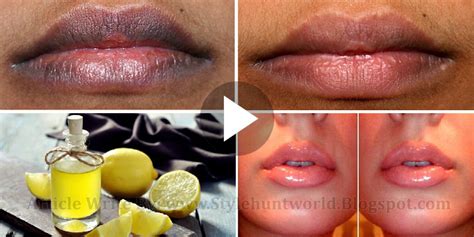 3 simple home remedies to get rid of dark lips naturally
