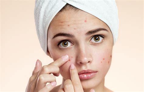 acne what to do and what not to do freestyler