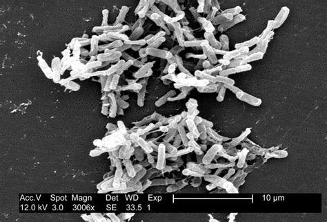 clostridium perfringens bacteria britannica