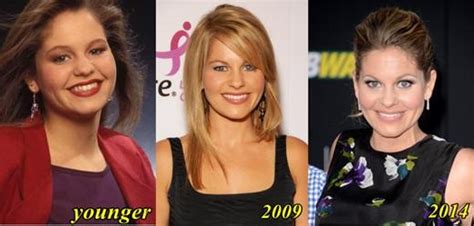 Candace Cameron Plastic Surgery With Before And After Photos