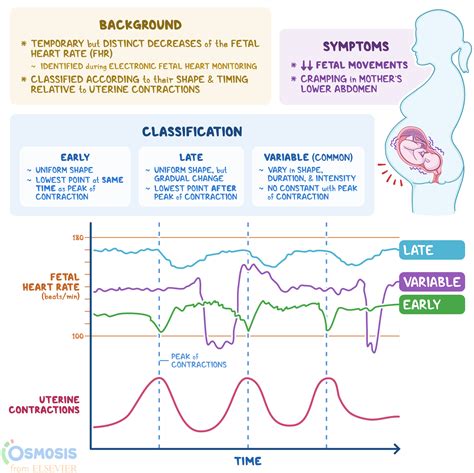 fetal decelerations       osmosis