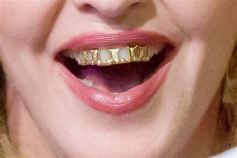oral piercings  teeth grills mark osmond dental clinic