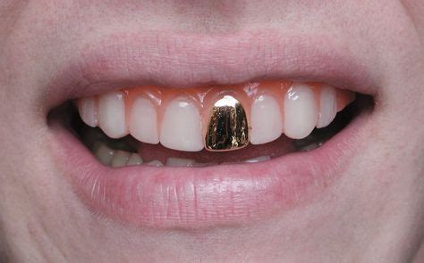 gold teeth images gold teeth teeth grillz