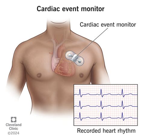 list  images     day heart monitor   stunning