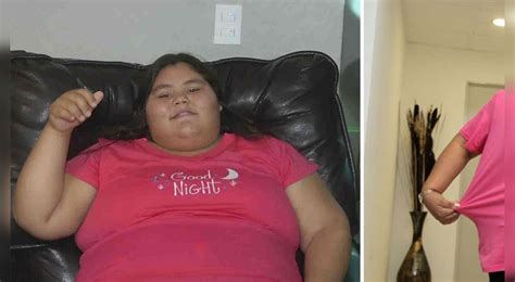 Fue Llamada La “adolescente Más Obesa Del Mundo” Al Pesar 195 Kilos