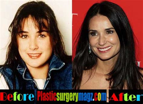 Demi Moore Plastic Surgery Before And After Plastic