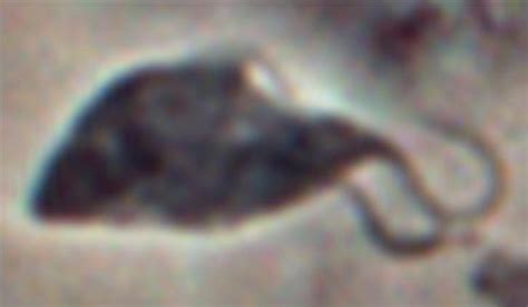 human african sleeping sickness sex cells in parasites are doing their