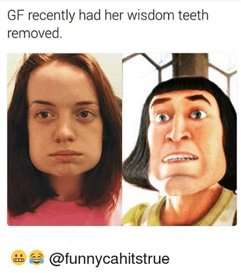 18 Wisdom Teeth Memes That Are Too Funny For Words