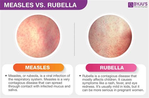 difference betwen measles  rubella measles  rubella byjus