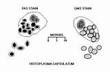 Utah Med Edu Histoplasmosis Capsule Fungal Rotation Stop Start Fungi Webpath Infection Library sketch template