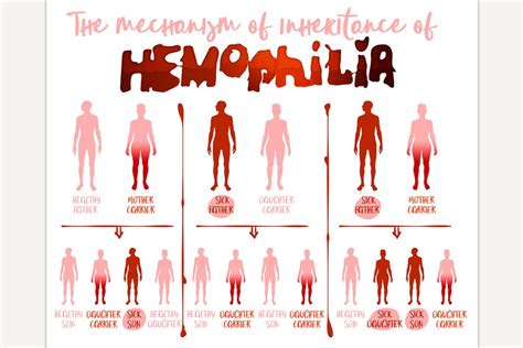 hemophilia causes poster pre designed photoshop graphics ~ creative