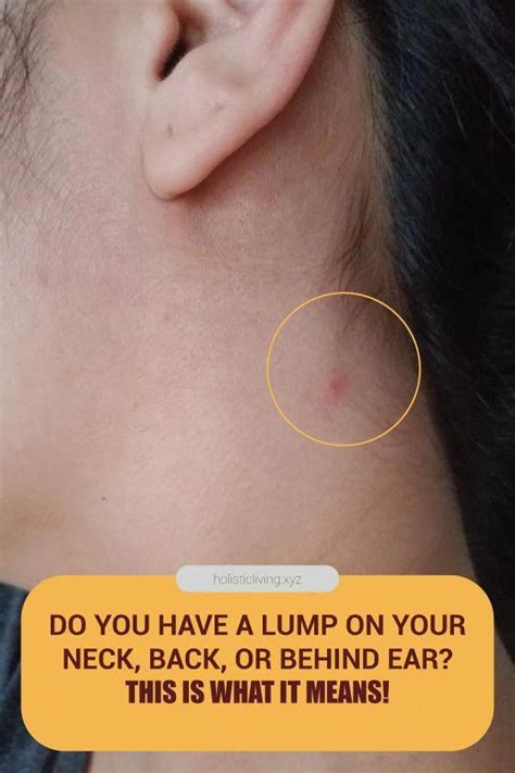 youve   lump   neck     ear      means