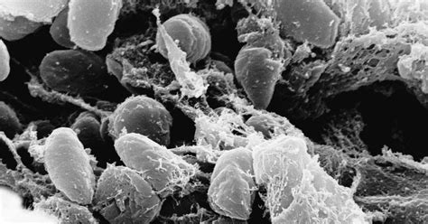 plague exists       time disease  lurking