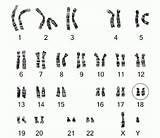 Chromosome Karyotype Chromosomes Chromosomen Markings sketch template