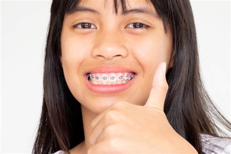 Girl With Teeth Brace Porn Videos Newest Justice For Girls Braces