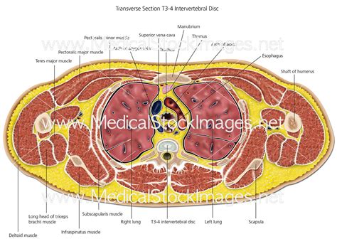 transverse section    intervertebral disc labelled medical