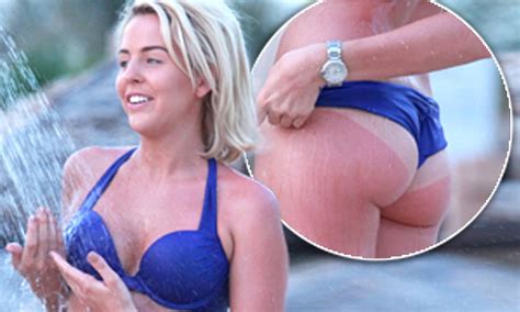 Lydia Bright Shows Off One Very Sunburned Bikini Bottom As