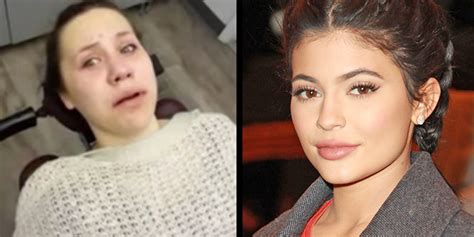 this teen woke up after surgery thinking she s kylie