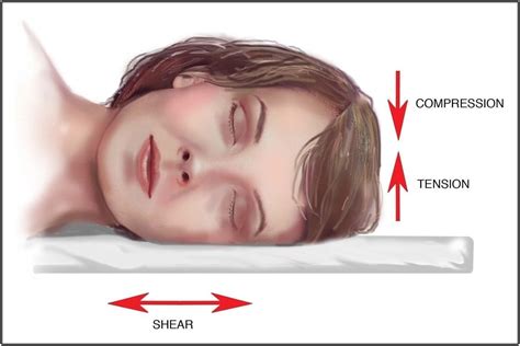 does sleeping on your side cause wrinkles botox® and juvÉderm® fillers