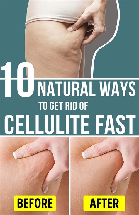 natural ways   rid  cellulite fast