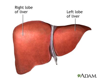 alcoholic liver disease uf health university  florida health