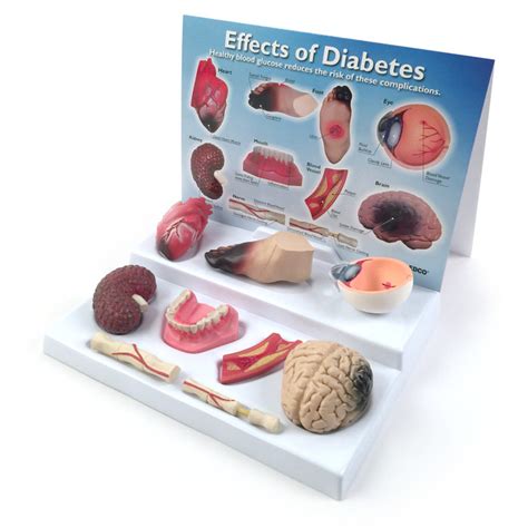 effects of diabetes educational display health edco