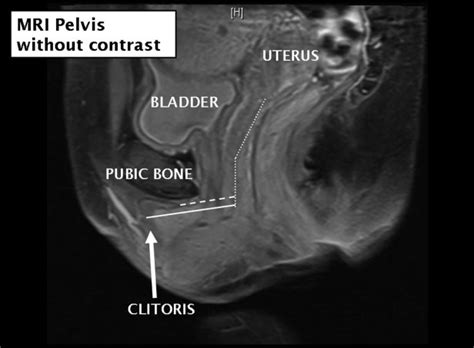 Womens Orgasm Woes Could Clitoris Be The Culprit Live Science