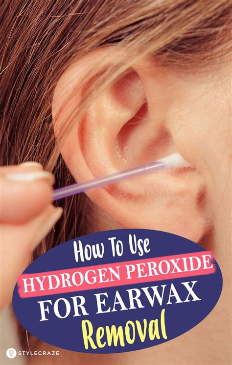 remove ear wax hydrogen peroxide  water howtormeov