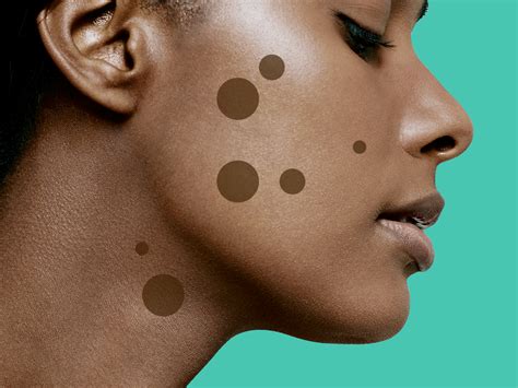 dark spot treatments   work   dermatologists
