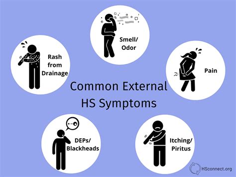 common external hs symptoms
