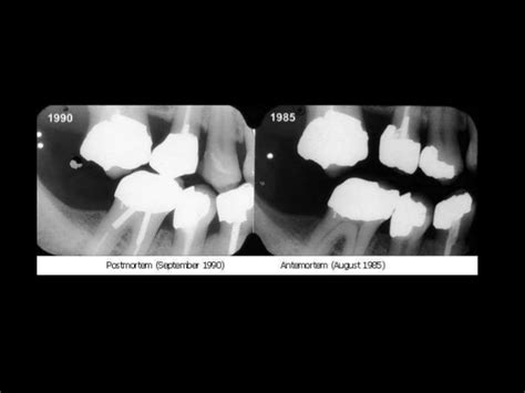 forensic odontology by dr revath vyas devulapalli