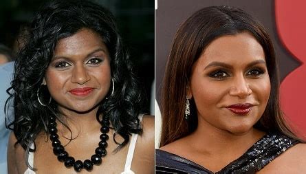 mindy kaling plastic surgery rumors compare    pictures