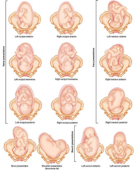 fetal positions nursing nclex pinterest midwifery ob nursing and